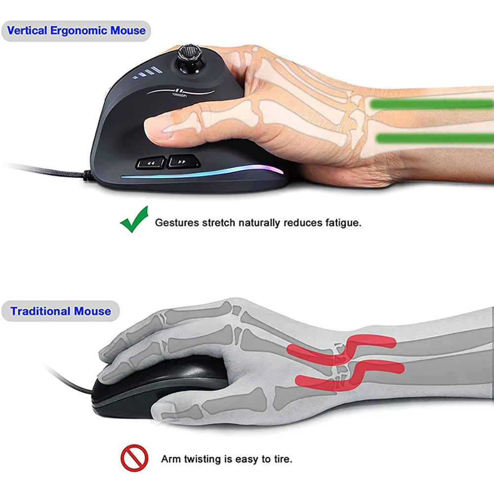 Vertical Gaming Mouse Wired RGB Ergonomic Mouse USB Joystick Programmable Gaming Mice for PC Computer Gamers